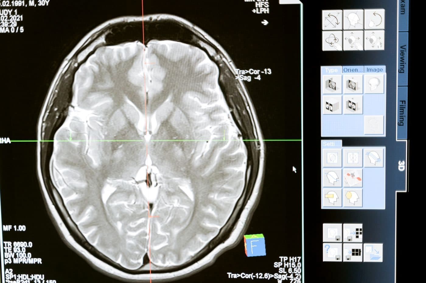 Radiologist reviewing mammography imaging on a diagnostic workstation, editorial context image