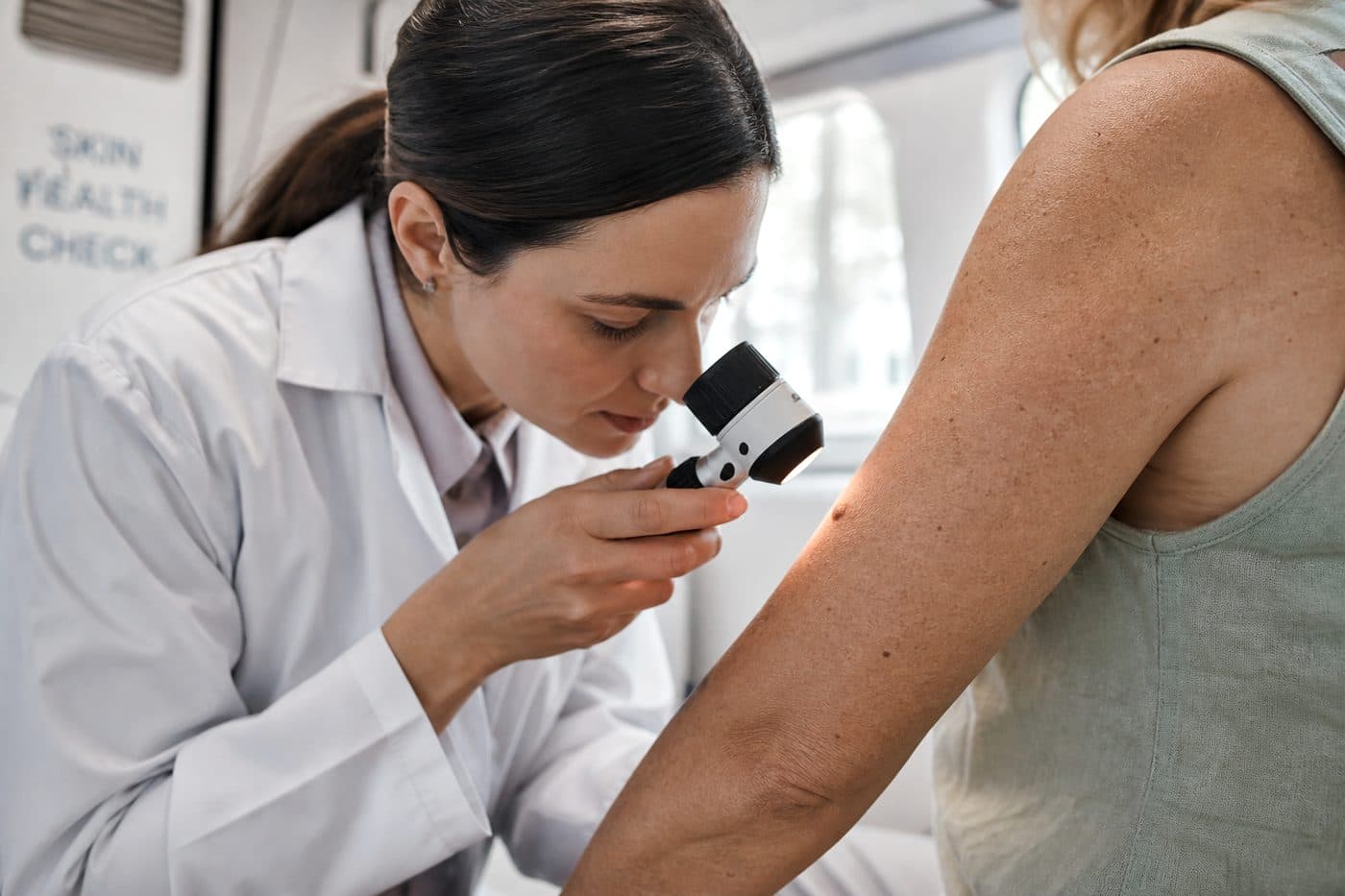 Dermatologist examining a skin lesion with a dermatoscope, editorial context image